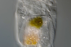 DG-Polyarthra-sp.-01-210x75-µm