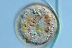 Arcella sp. mit Nucleophaga amoebae