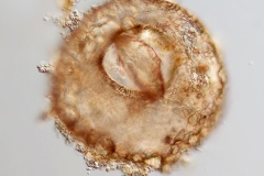 Centropyxis sp.