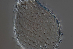 Euglypha ciliata