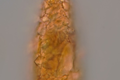 GT-Difflugia-cf.-cylindrus-02-185x75-µm