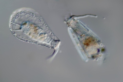 PPW-Nebela-190-µm-trifft-Difflugia-170-µm-LD