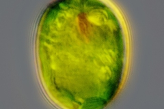 Trachelomonas cf. manginii
