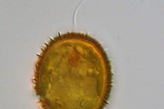 Trachelomonas sp.