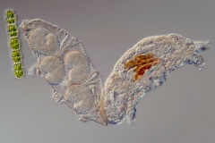 vermutlich Hypsibius sp.