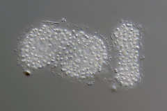 Coelosphaerium sp.