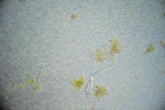 Aphanocapsa planctonica