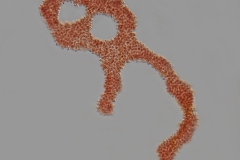 Microcystis aeruginosa