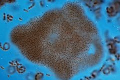 Microcystis flos-aquae