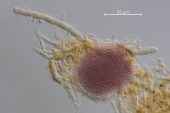 Schwefelbakterien und Leptothrix ochracea