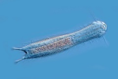 Chaetonotus sp.