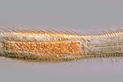 Chaetonotus sp.