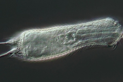 Chaetonotus sp.