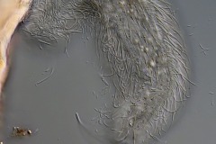 Chaetonotus sp.