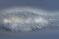 Chaetonotus elegans