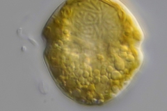 Dinoflagellat - noch unbestimmt