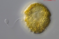 Dinoflagellat - noch unbestimmt