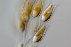 Dinobryon sertularia