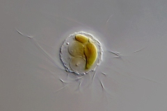 Mallomonas sp.