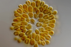 Synura sp.