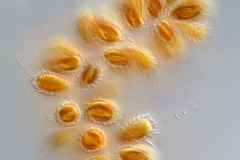 Synura spinosa