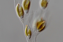 Dinobryon sertularia