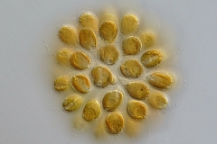 Synura sp.