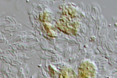 Synura petersenii (Schuppen)