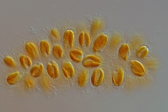 Synura spinosa