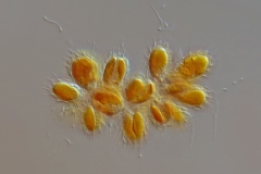 Synura spinosa