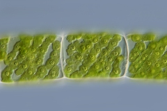 Spirogyra sp.