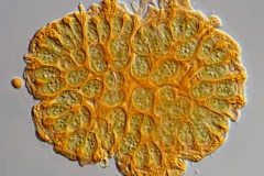 Botryococcus braunii
