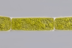 cf. Microspora sp.