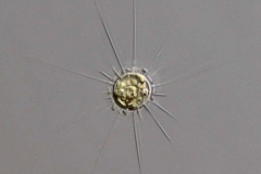 Golenkinia radiata