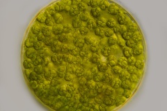 Eremosphaera viridis (2)