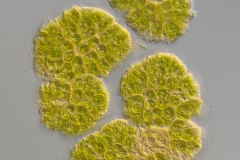 Botryococcus braunii