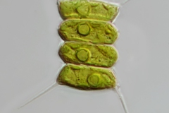 Scenedesmus quadricauda