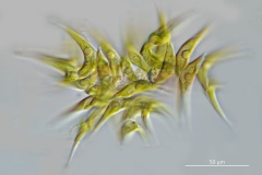Tetradesmus lagerheimii