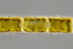 Melosira sp. 1