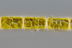 Melosira sp. 2