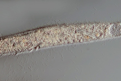 Spirostomum cf. minus.
