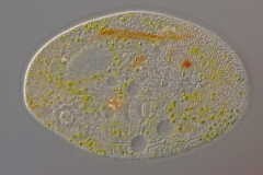 Frontonia leucas oder vernalis