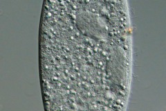 Amphileptus sp.