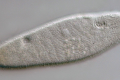 Ophryoglena flava