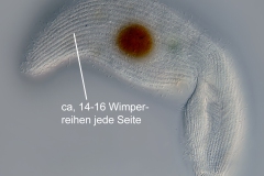 Condylostoma cf. rugosum