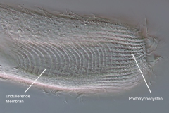 Condylostoma cf. rugosum