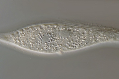 Amphileptus pleurosigma