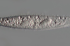 Amphileptus sp.