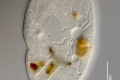 Frontonia leucas (5)