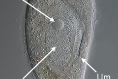 Metopus es